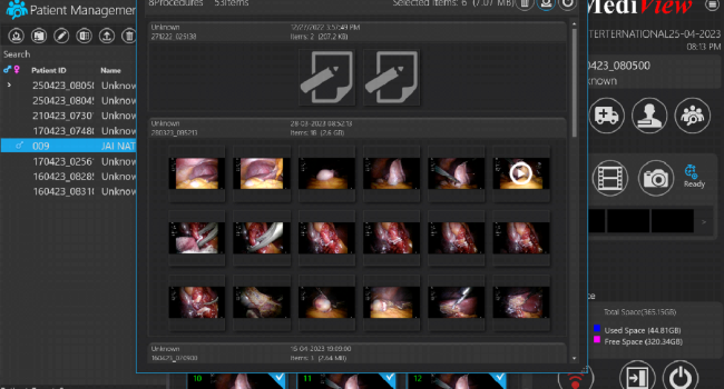 ENDOSCOPE IMAGES