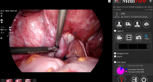 ENDOSCOPIC IMAGES